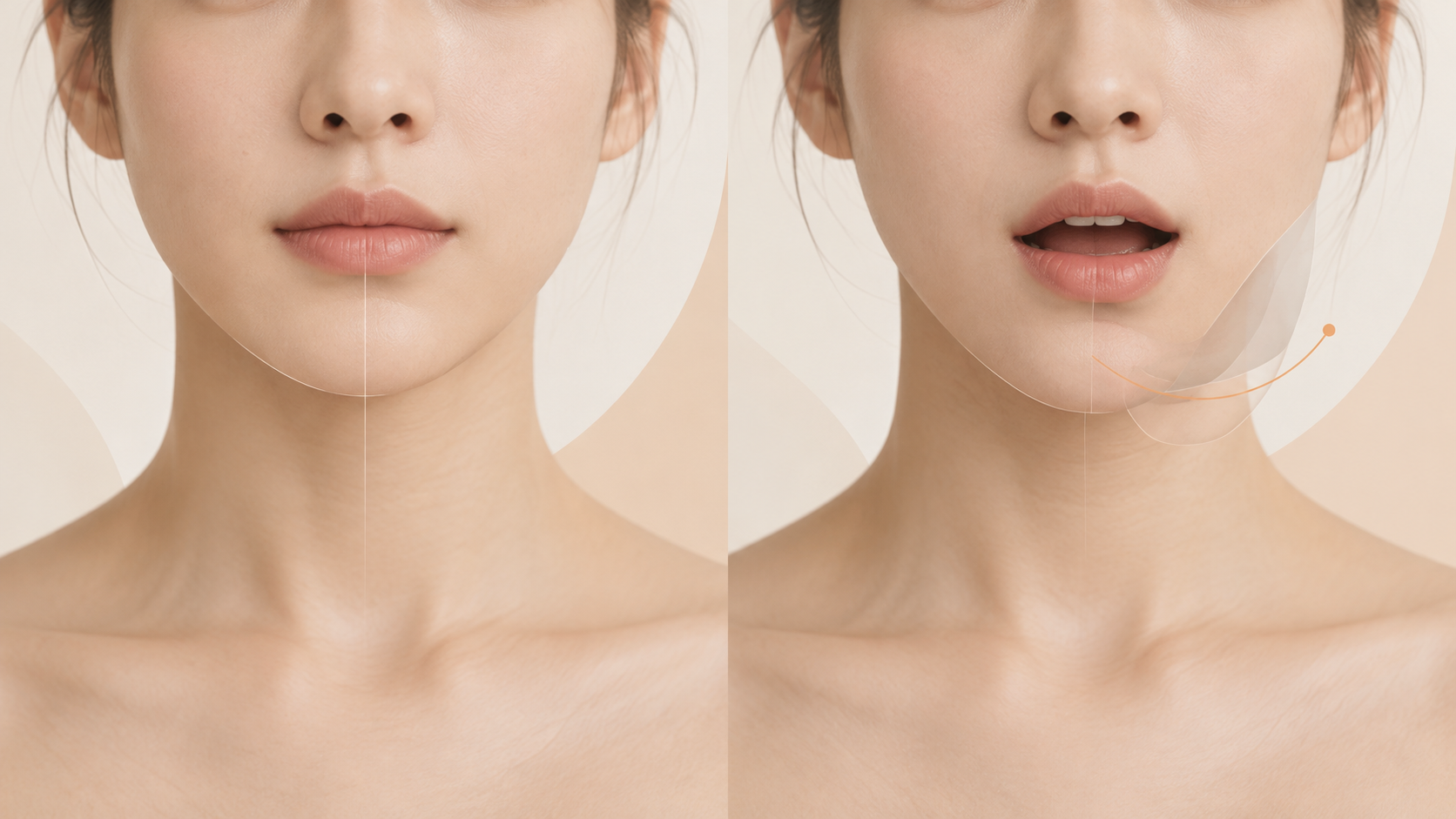 입을 다문 상태와 벌린 상태의 턱끝 위치를 비교하는 의료 설명 이미지